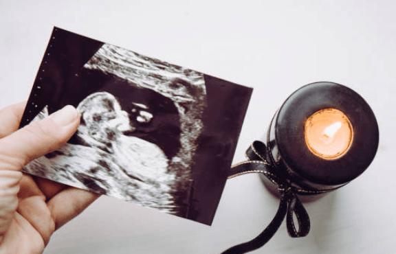 Baby:7s0unpvofpi= Miscarriage Blood at 6 Weeks